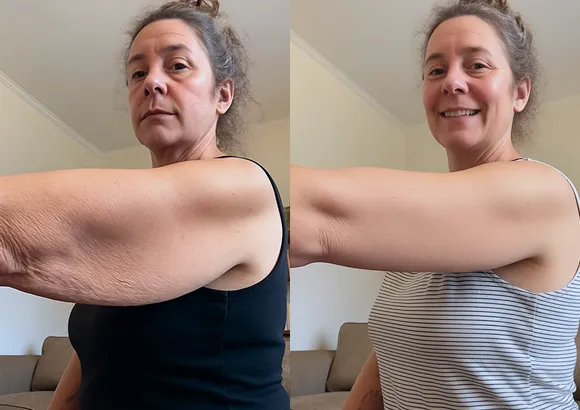 Side-by-side photo of a woman's upper arm before and after consistent use of the featured formula, showing improved firmness and tone in the after image